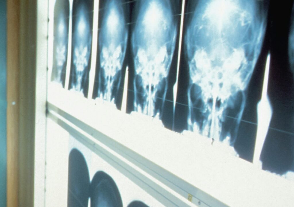 Radiologia