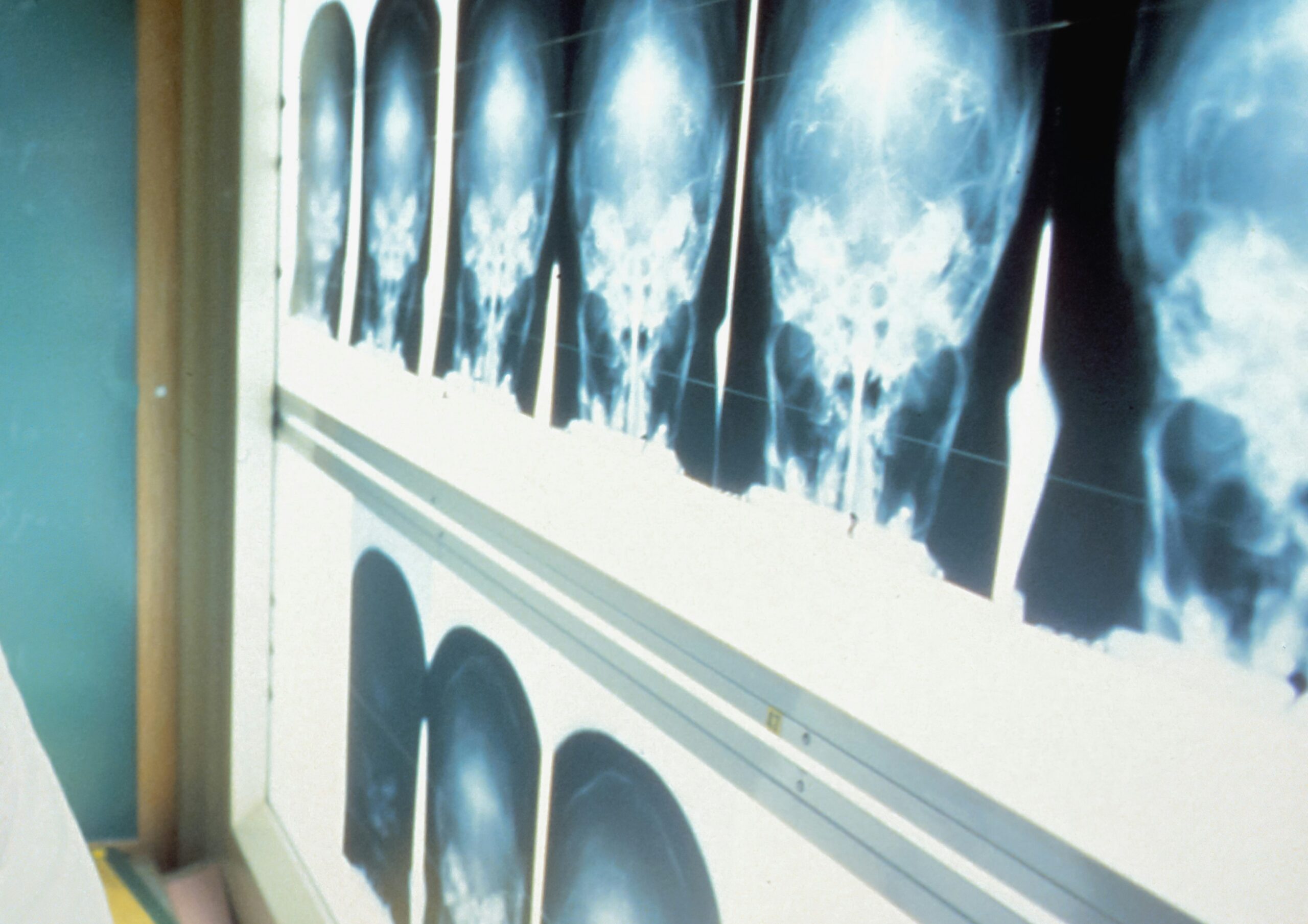 RADIOLOGIA w warsztacie fizjoterapeuty